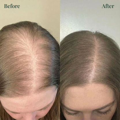 Organic Rosemary Hair Growth Shampoo