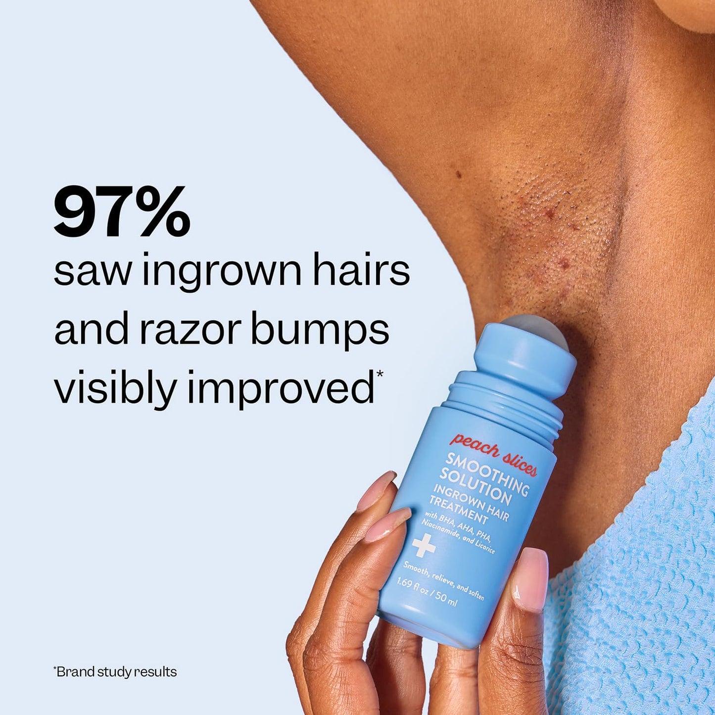 Ingrown Hair Treatment