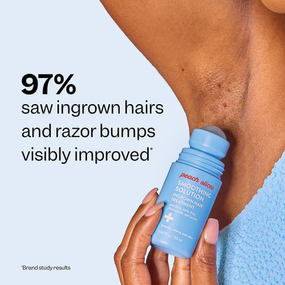 Ingrown Hair Treatment