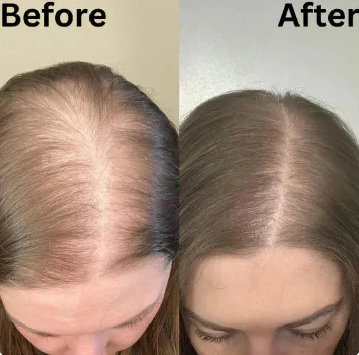 Rosemary Amino Acid Shampoo