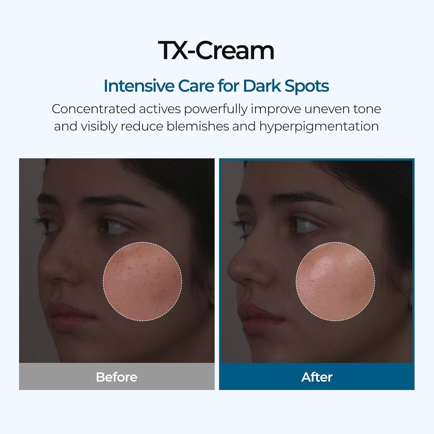 Tranexamic Acid Brightening Cream