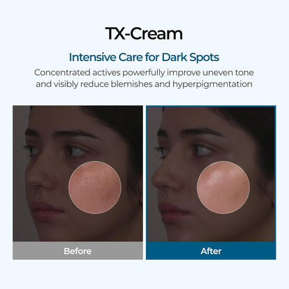 Tranexamic Acid Brightening Cream